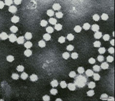 bad feh pos tsv|Summary of Taura syndrome virus (TSV) infection challenges.